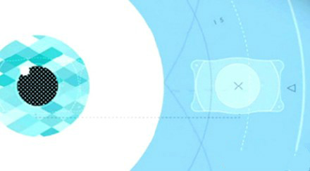 icl晶体植入术术后有后遗症吗？